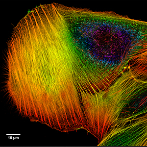 https://en.wikipedia.org/wiki/File:Depth_Coded_Phalloidin_Stained_Actin_Filaments_Cancer_Cell.png